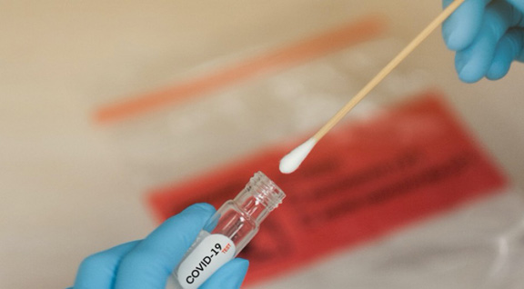 بنزرت..ارتفاع نسبة التحاليل الايجابية الى 36 بالمائة