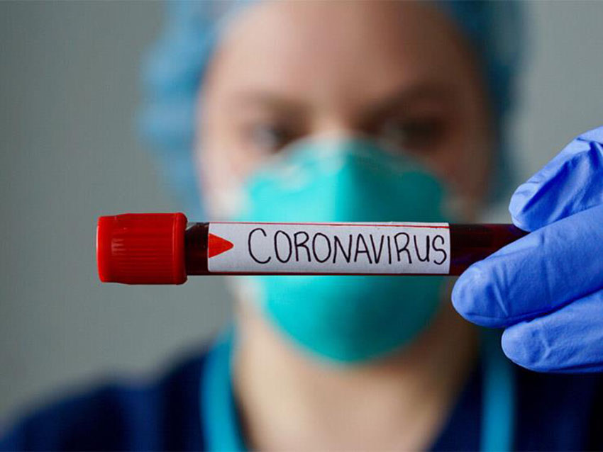 230 حالة إصابة بفيروس كورونا خلال اوت المنقضي 