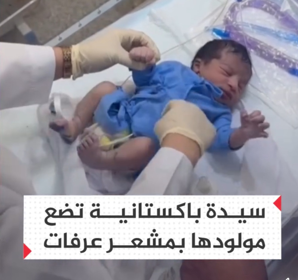 سيدة باكستانية تضع مولودها أثناء الحج 