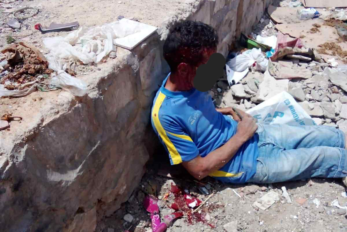   سوسة.. الإعتداء بالعنف الشديد على عون نظافة