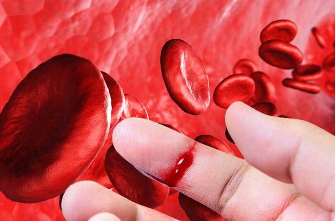 رئيسة الجمعية التونسية لمرض «الهيموفيليا» لـ«الصباح»:   700 مريض بـ«الهيموفيليا» في تونس ودعوة إلى مراجعة أسعار الأدوية