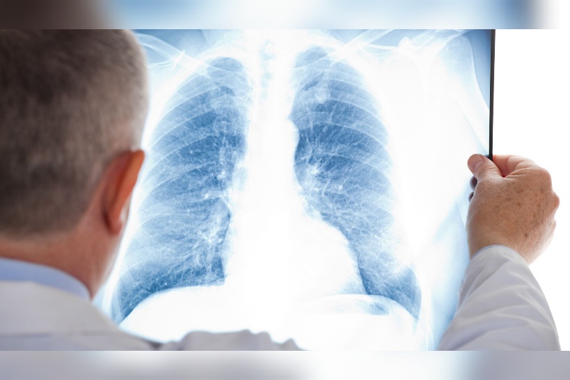 د.فاطمة الشرميطي: تونس تسجّل سنويا بين 100 و150 إصابة جديدة بمرض التليّف الرئوي الأوّلي