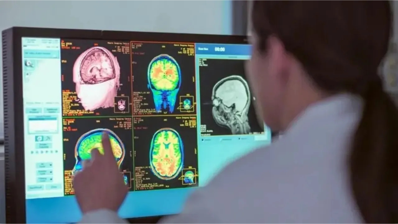 رغم التلوث والتوتر.. المدن المكتظة قد تحمي الدماغ!