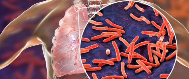 اليوم العالمي لمكافحة السل.. عميد الأطباء البيطريين يؤكد أن القضاء على السل العقدي ممكن عبر تكريس مفهوم الصحة الواحدة  