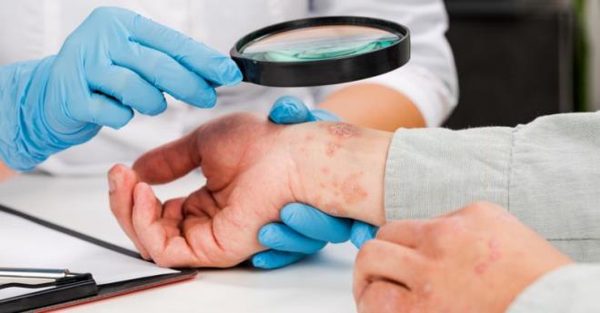 مختصة في الأمراض الجلدية تحذّر من أن المشاكل الجلدية قد تكون مؤشرا على الإصابة بعدة أمراض خطيرة