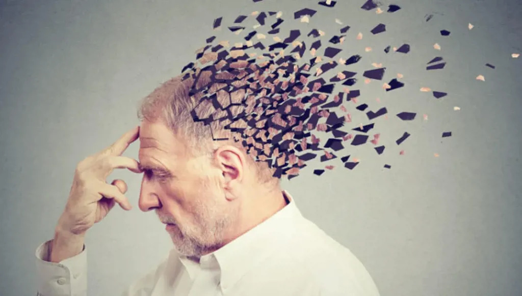 التغيرات الدماغية في مرض الزهايمر تختلف حسب الجنس