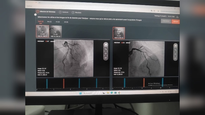 مدنين.. لأول مرة تركيب وتشغيل برنامج تحليل QFR بالمستشفى الجامعي 